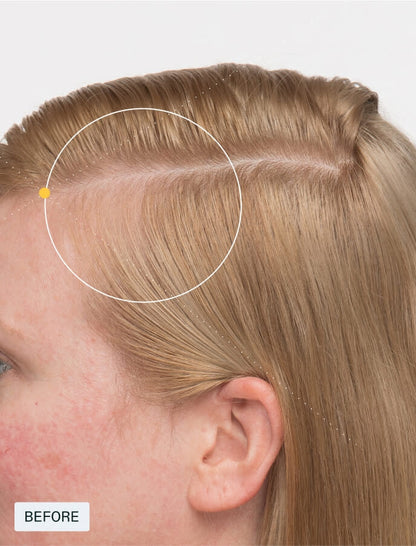Nutrafol Women's Balance Hair Growth Supplements