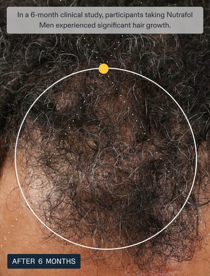 Supplements Nutrafol Men Hair Growth